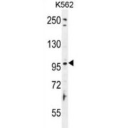 Taste Receptor Type 1 Member 2 (TAS1R2) Antibody