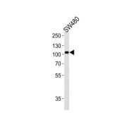 WB analysis of SW480 cell lysates, using LRP12 antibody (1/1000 dilution).