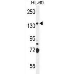 SOS Ras/Rho Guanine Nucleotide Exchange Factor 2 (SOS2) Antibody