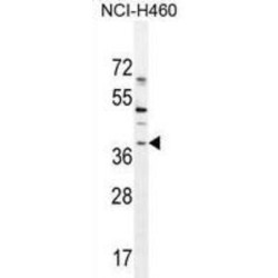 Transcription Factor SOX-1 (SOX1) Antibody