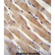 Ras Homolog Enriched In Brain (RHEB) Antibody