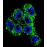 Transient Receptor Potential Cation Channel Subfamily M Member 8 (TRPM8) Antibody