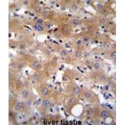 Transient Receptor Potential Cation Channel Subfamily M Member 8 (TRPM8) Antibody