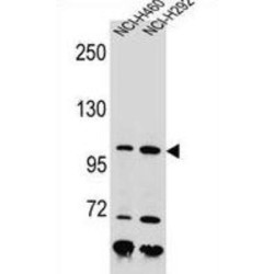 Nibrin (NBN) Antibody