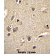 Protein S100-A1 (S100A1) Antibody