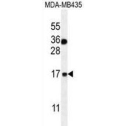 Protein S100-A1 (S100A1) Antibody