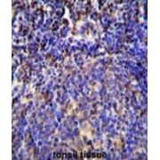 Protein S100-A4 (S100A4) Antibody