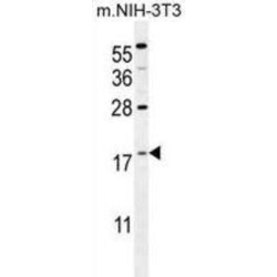 Protein S100-A4 (S100A4) Antibody