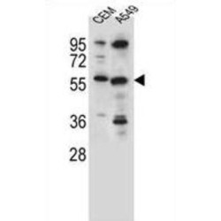 Cysteine Sulfinic Acid Decarboxylase (CSAD) Antibody