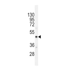 Chromogranin-A (CMGA) Antibody