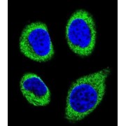 Cytosolic Carboxypeptidase 5 (AGBL5) Antibody