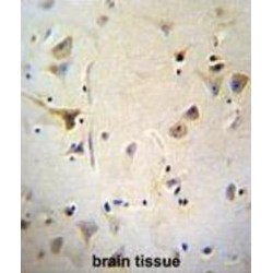 Cytosolic Carboxypeptidase 5 (AGBL5) Antibody