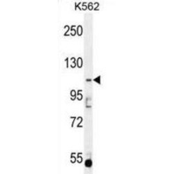 Cytosolic Carboxypeptidase 5 (AGBL5) Antibody