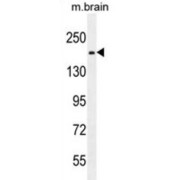 RB1 Inducible Coiled-Coil 1 (RB1CC1) Antibody