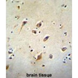 Putative Aspartate Aminotransferase, Cytoplasmic 2 (GOT1L1) Antibody