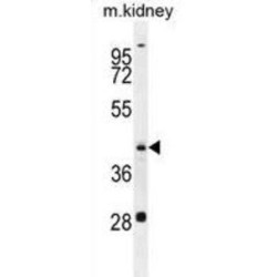 Putative Aspartate Aminotransferase, Cytoplasmic 2 (GOT1L1) Antibody