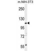 Coiled-Coil Domain Containing 158 (CCDC158) Antibody