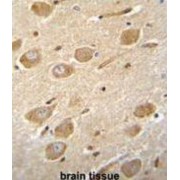 Cyclic Nucleotide-Gated Cation Channel Alpha-4 (CNGA4) Antibody