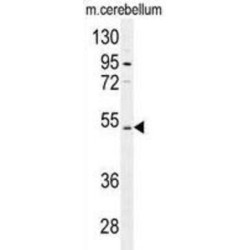 Cyclic Nucleotide-Gated Cation Channel Alpha-4 (CNGA4) Antibody