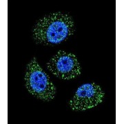 Myosin-Binding Protein H-Like (MYBPHL) Antibody