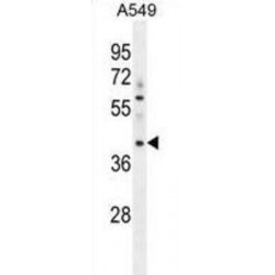 Myosin-Binding Protein H-Like (MYBPHL) Antibody