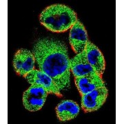 Suppressor of Cytokine Signaling 4 (SOCS4) Antibody