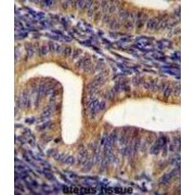 Growth Hormone Secretagogue Receptor (GHSR) Antibody