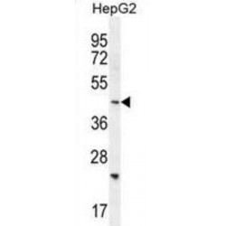 SH2D4B Antibody