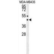 Suppressor of Variegation 3-9 Homolog 1 (SUV39H1) Antibody