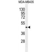 Lipase Member K (LIPK) Antibody