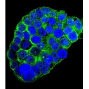 Complement Component 1q Subcomponent C (C1qC) Antibody