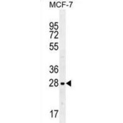 Lectin-Galactoside Binding Soluble 3 (LGALS3) Antibody