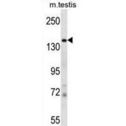 JmjC Domain-Containing Histone Demethylation Protein 2A (JHDM2a) Antibody