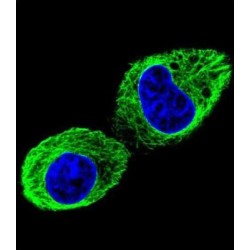 Tubulin Beta 2B (TUBB2B) Antibody