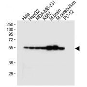 Western blot analysis of HeLa (Lane 1), HepG2 (Lane 2), MDA-MB-231 (Lane 3), K562 (Lane 4) cell lysates, Mouse brain (Lane 5), cerebellum (Lane 6) tissue homogenates and PC-12 (Lane 7) cell lysates (20 µg/lane), using Tubulin Beta 2B (TUBB2B) Antibody (1/4000 dilution) and HRP-conjugated Goat Anti-Rabbit IgG, H+L secondary antibody (1/10000 dilution). Heat mediated antigen retrieval was carried out in EDTA, pH 6.0 prior to staining. Blocking and dilution buffer: 5% NFDM/TBST.<br>Calculated MW: 50 kDa