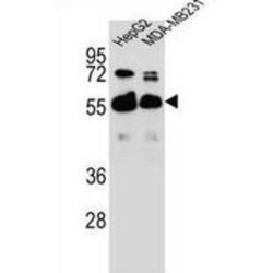 Rap1 GTPase-GDP Dissociation Stimulator 1 (RAP1GDS1) Antibody