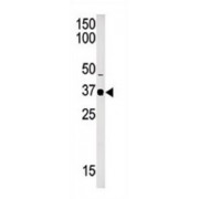 Histone-Lysine N-Methyltransferase SETD7 (SET7) Antibody