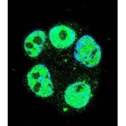 Methyltransferase-Like Protein 2 (METTL2) Antibody