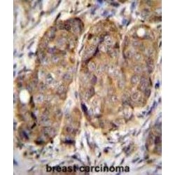 Methyltransferase-Like Protein 2 (METTL2) Antibody