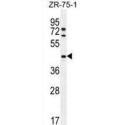 Methyltransferase-Like Protein 2 (METTL2) Antibody