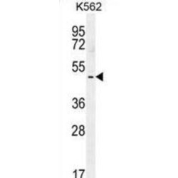 T-Box Protein 6 (TBX6) Antibody