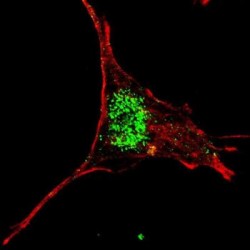 Krueppel-Like Factor 4 (KLF4) Antibody