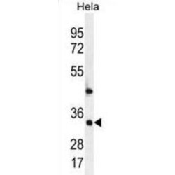 Mediator of RNA Polymerase II Transcription Subunit 7 (MED7) Antibody