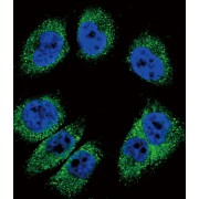 Periostin (POSTN) Antibody