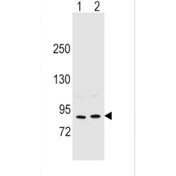 Periostin (POSTN) Antibody