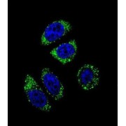 Endothelin 1 (EDN1) Antibody