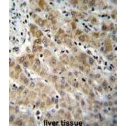 Endothelin 1 (EDN1) Antibody