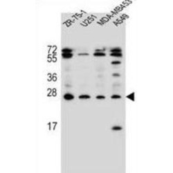 Endothelin 1 (EDN1) Antibody