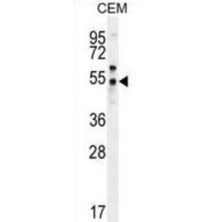 Prostate-Specific Membrane Antigen-Like Protein (PSMAL) Antibody