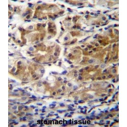 Pyruvate Dehydrogenase Phosphatase Regulatory Subunit, Mitochondrial (PDPR) Antibody